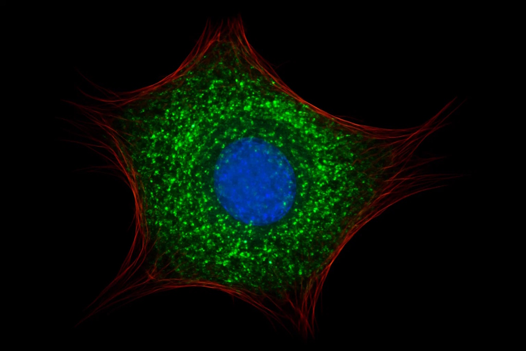 A revolution in cell biology: the pups AI model from mit and Harvard accurately predicts the locations of disease-fighting proteins